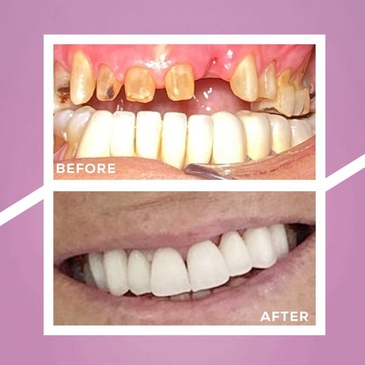 Slider image (4) Dent Antalya